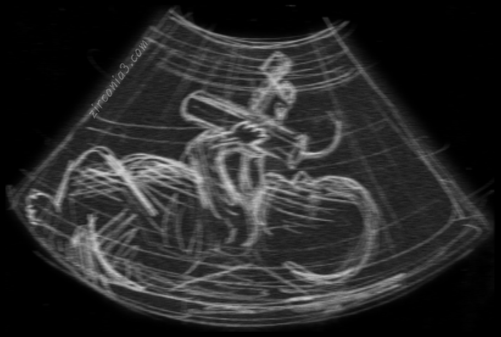 025GasPoweredHearingAid